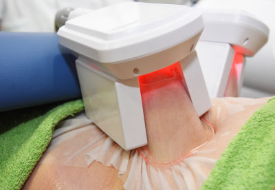 Fat Freezing Treatment